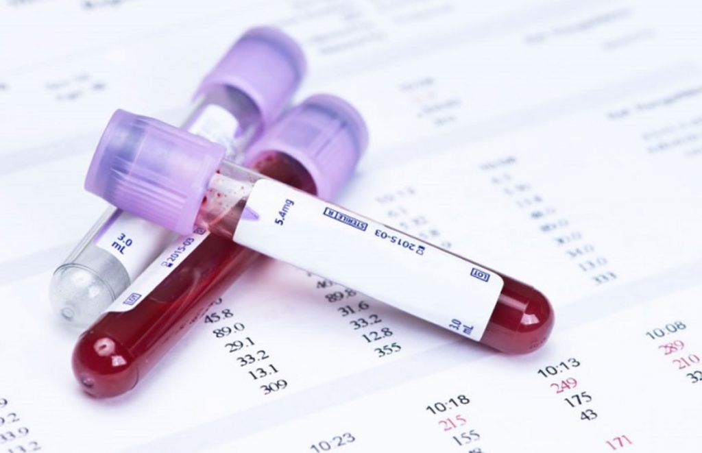 Blood test, test tubes